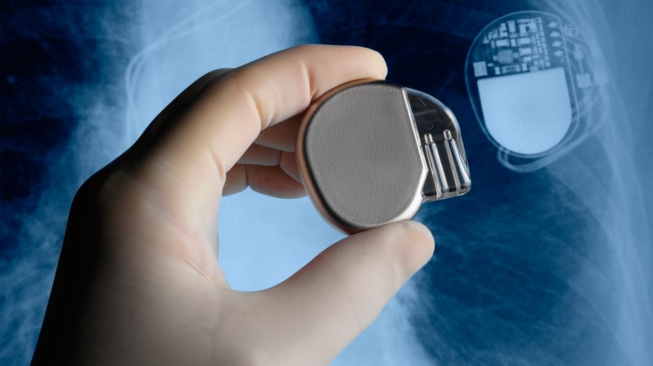 Medical implants are super vulnerable to cyber attacks